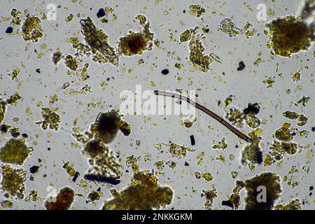 micro-organismes du sol dans un échantillon de sol, champignon du sol et bactérie dans une ferme régénératrice en compost. les champignons hyphes dans un essai de sol. en australie Banque D'Images