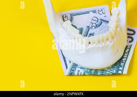 mâchoire d'un homme avec des dents et des billets de monnaie, mâchoire inférieure, billet de banque de dollars, objets, dents propres blanches, se tient sur la surface du dos jaune Banque D'Images