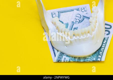 mâchoire d'un homme avec des dents et des billets de monnaie, mâchoire inférieure, billet de banque de dollars, objets, dents propres blanches, se tient sur la surface du dos jaune Banque D'Images