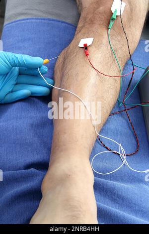 Électromyographie EMG et Somatosensory potentiel évoqué de la VEP des membres inférieurs, test neurophysiologique applique des stimuli électriques près des nerfs Banque D'Images