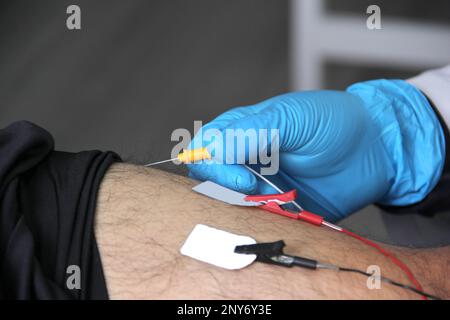 Électromyographie EMG et Somatosensory potentiel évoqué de la VEP des membres inférieurs, test neurophysiologique applique des stimuli électriques près des nerfs Banque D'Images
