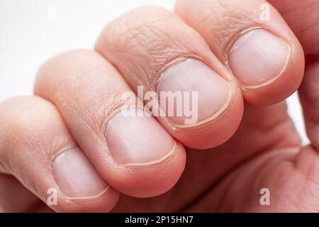 Gros plan sur les doigts et les ongles mâles. Prise de vue en studio, aucune personne, isolée sur fond blanc. Banque D'Images