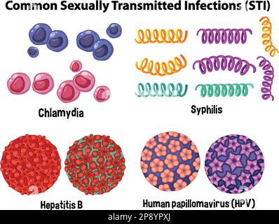 Illustration des infections sexuellement transmissibles courantes (ITS) Illustration de Vecteur