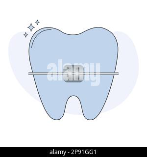 Jolie dent avec bretelles en métal dentaire. Prothèses dentaires sur la dent orthodontique correction concept. Illustration vectorielle plate Illustration de Vecteur