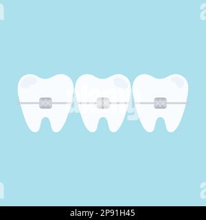 Dents avec bretelles. Bretelles dentaires. Dentisterie orthodontique. Illustration vectorielle plate Illustration de Vecteur