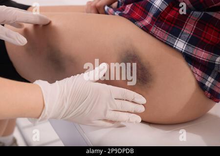 Médecin examinant la hanche contusionnée du patient à l'hôpital, en gros plan Banque D'Images