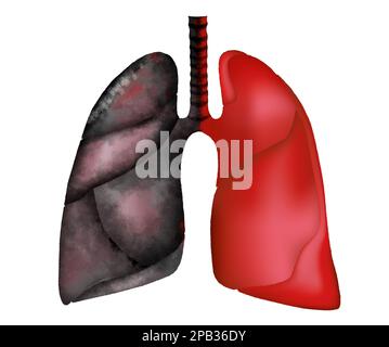 Illustration des poumons humains - sains et affectés par la maladie sur fond blanc Banque D'Images