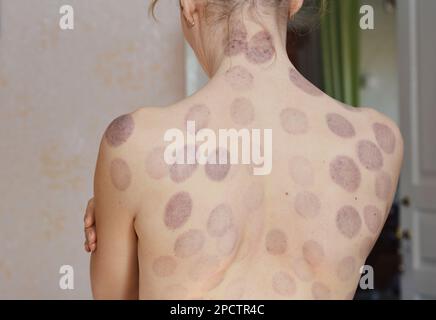 La femme est de retour après avoir appliqué un traitement chinois par immersion. Les avantages du concept de thérapie par trempage. Banque D'Images