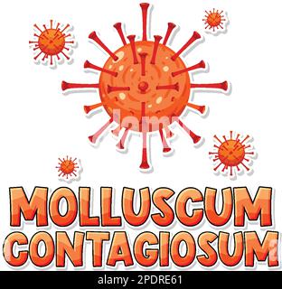 Virus de la maladie de Moluskum contagiosum sur fond blanc illustration Illustration de Vecteur