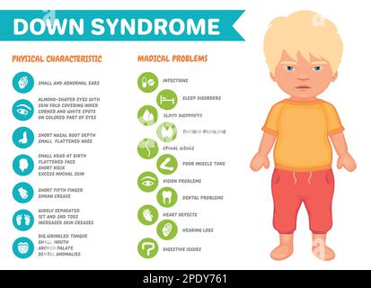 Affiche d'infographie sur les symptômes du syndrome de Down Illustration de Vecteur