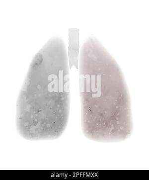 Illustration de l'aquarelle vectorielle des poumons malades. Système respiratoire fumé. Gris silhouette provenant de poumons de fumée isolés de l'arrière-plan. Illustration de Vecteur