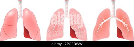 Anatomie des poumons. Coupe transversale des voies respiratoires humaines avec trachée, larynx et bronches. Structure du système de respiration. Vecteur réaliste Illustration de Vecteur