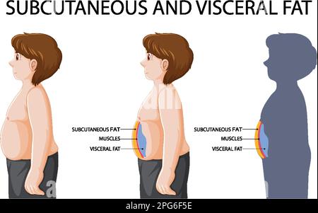 Illustration du schéma de la graisse sous-cutanée et viscérale Illustration de Vecteur
