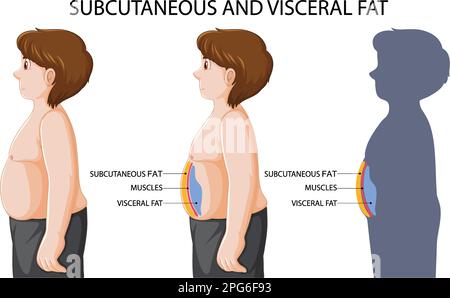 Illustration du schéma de la graisse sous-cutanée et viscérale Illustration de Vecteur