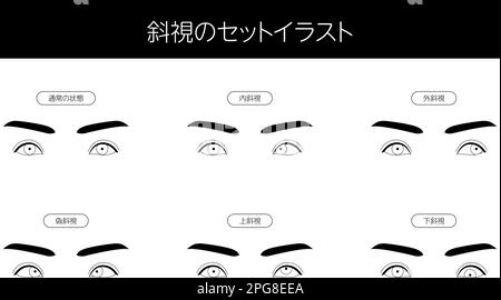 Illustration médicale, maladies oculaires de l'ensemble d'illustrations et strabisme - Traduction: Clip art de l'ensemble de strabisme, normal, esotropia, Exotropia, Pseudostra Illustration de Vecteur