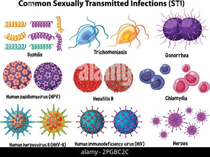 Illustration des infections sexuellement transmissibles courantes (ITS) Illustration de Vecteur