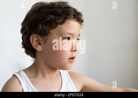 Le garçon était gonflé par des allergies. Allergie au pollen ou à la nourriture. Banque D'Images