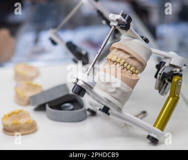 Plâtre moulé de la mâchoire dans l'articulation dans l'atelier de prothèse. Banque D'Images