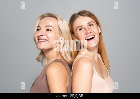 Les femmes gaies avec des problèmes de peau se tenant dos à dos isolé sur gris, image de stock Banque D'Images