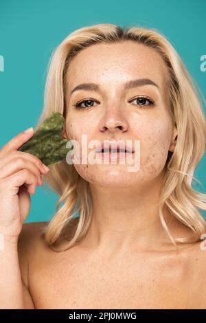 femme blonde avec des imperfections visage massants avec le grattoir de visage jade isolé sur turquoise, image de stock Banque D'Images