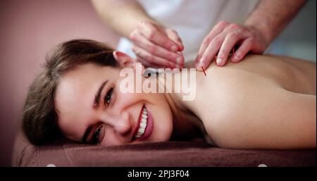 Traitement d'acupuncture à aiguille sèche. Thérapie Spa médicale féminine Banque D'Images