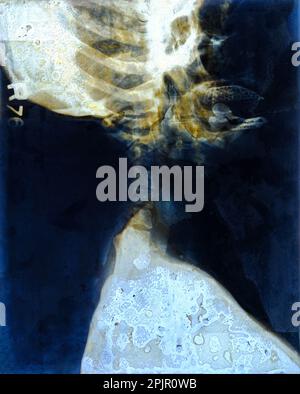 Film x-ray du crâne et de la colonne cervicale vue latérale. Banque D'Images