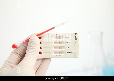Médecin tenant un test express jetable pour l'hépatite et pipette avec du sang à l'intérieur, gros plan Banque D'Images