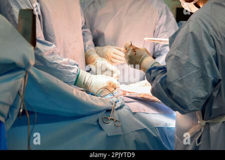 les mains de gros plan des chirurgiens pédiatriques effectuent une chirurgie à l'aide de ports laparoscopiques pour la chirurgie endoscopique. Dans une salle d'opération stérile. Chirurgie pédiatrique, Banque D'Images