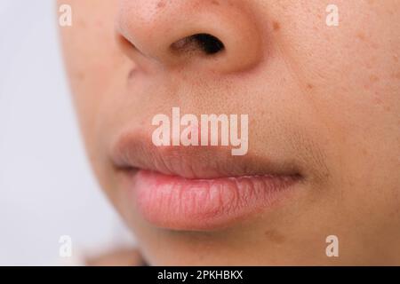 Gros plan des taches de rousseur sur le visage de la femme asiatique. Femme d'âge moyen avec rides, imperfections, taches sombres, taches de rousseur, peau sèche sur son visage. Problèmes de soins de la peau Banque D'Images