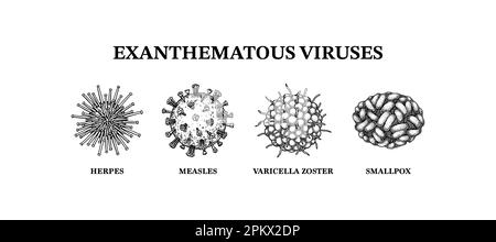 Virus exanthemateux. Jeu de micro-organismes dessiné à la main. Illustration vectorielle scientifique dans un style d'esquisse. Illustration de Vecteur