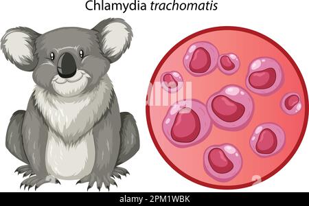 Chlamydia trachomatis avec illustration explicative Illustration de Vecteur