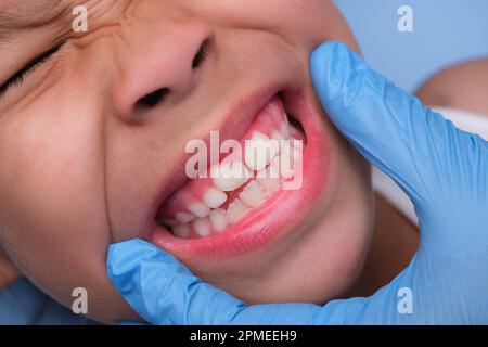 Gros plan à l'intérieur de la cavité buccale d'un enfant en bonne santé avec de belles rangées de dents de bébé. Jeune fille ouvre la bouche révélant les dents supérieures et inférieures, PAL dur Banque D'Images