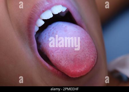 Gros plan à l'intérieur de la cavité buccale d'un enfant en bonne santé avec de belles rangées de dents de bébé. Jeune fille ouvre la bouche révélant les dents supérieures et inférieures, PAL dur Banque D'Images