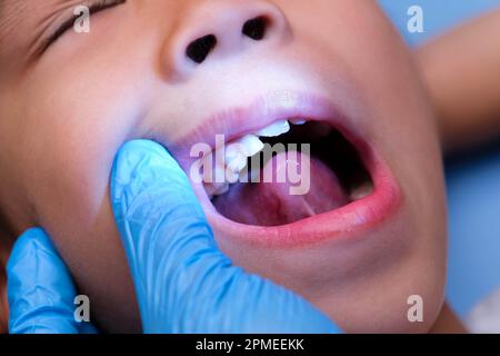 Gros plan à l'intérieur de la cavité buccale d'un enfant en bonne santé avec de belles rangées de dents de bébé. Jeune fille ouvre la bouche révélant les dents supérieures et inférieures, PAL dur Banque D'Images