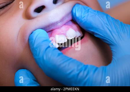 Gros plan à l'intérieur de la cavité buccale d'un enfant en bonne santé avec de belles rangées de dents de bébé. Jeune fille ouvre la bouche révélant les dents supérieures et inférieures, PAL dur Banque D'Images