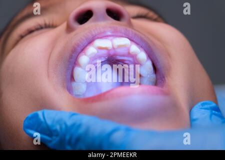 Gros plan à l'intérieur de la cavité buccale d'un enfant en bonne santé avec de belles rangées de dents de bébé. Jeune fille ouvre la bouche révélant les dents supérieures et inférieures, PAL dur Banque D'Images