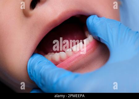 Gros plan à l'intérieur de la cavité buccale d'un enfant en bonne santé avec de belles rangées de dents de bébé. Jeune fille ouvre la bouche révélant les dents supérieures et inférieures, PAL dur Banque D'Images