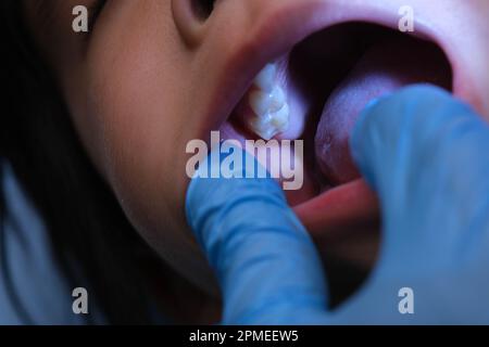 Gros plan à l'intérieur de la cavité buccale d'un enfant en bonne santé avec de belles rangées de dents de bébé. Jeune fille ouvre la bouche révélant les dents supérieures et inférieures, PAL dur Banque D'Images