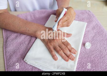 une femme âgée applique de la crème curative pour l'arthrite sur ses vieilles mains, la médecine Banque D'Images