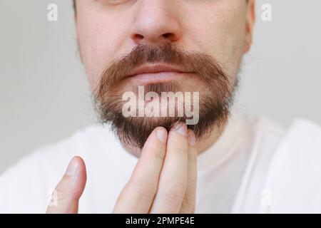 La photo rognée d'un homme barbu montre les premiers poils gris sur une barbe et une moustache trop grandies. La perte de mélanine à l'âge jeune, causes génétiques predispositio Banque D'Images