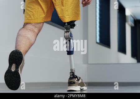 Homme méconnu dans un short jaune portant une jambe prothétique Banque D'Images