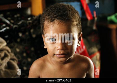 Un enfant mélanésien à la peau légère avec un nez qui coule Banque D'Images