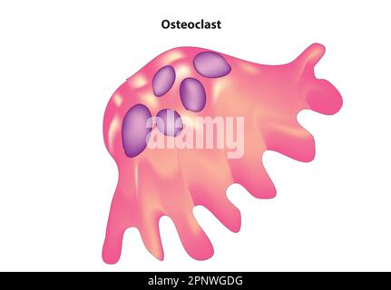 ostéoclaste Illustration de Vecteur