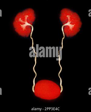 CTA image de rendu de l'artère rénale 3D montrant les deux reins, l'uretère et la vessie . Banque D'Images