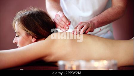 Traitement d'acupuncture à aiguille sèche. Thérapie Spa médicale féminine Banque D'Images
