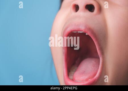 Gros plan à l'intérieur de la cavité buccale d'un enfant en bonne santé avec de belles rangées de dents de bébé. Jeune fille ouvre la bouche révélant les dents supérieures et inférieures, PAL dur Banque D'Images