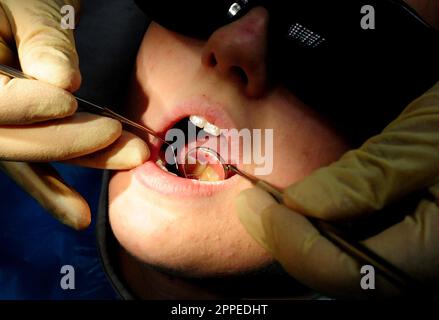 Photo du dossier datée du 19/05/2011 d'un dentiste au travail. Une personne sur quatre retarde ou va sans traitement dentaire NHS en raison de son coût croissant, a averti la British Dental Association (BDA). Date de publication : lundi 24 avril 2023. Banque D'Images