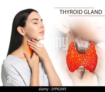 Femme et illustration de la glande thyroïde sur fond blanc Banque D'Images