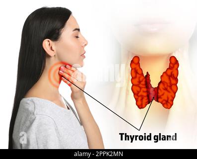Femme et illustration de la glande thyroïde sur fond blanc Banque D'Images