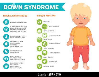 Infographie sur les symptômes du syndrome de Down Illustration de Vecteur